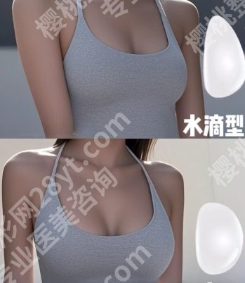 乌鲁木齐隆胸多少钱?2025价格一览+口碑医院top5分享