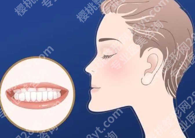 上海六院正颌手术价格贵不贵？真实案例|见证手术流程