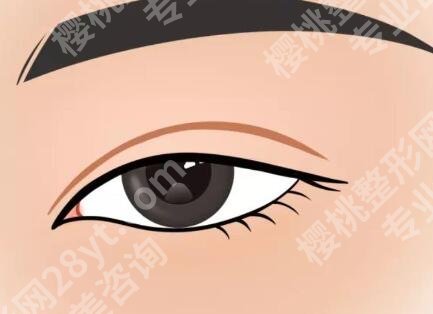 上海丁志双眼皮费用多少?全切双眼皮5139元起
