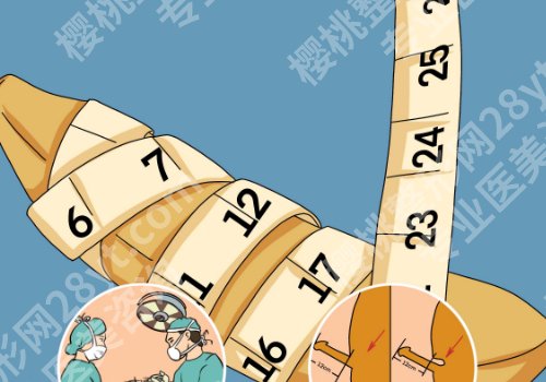 2025成都增长增粗医院排名更新!九龙、恒博、中医一附院上榜