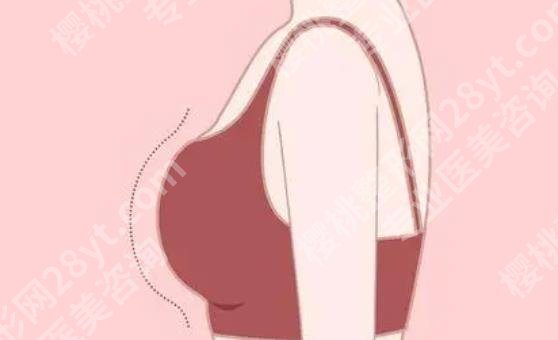 上海第九人民医院隆胸哪个医生好?王涛、何金光、俞哲元等技术不错!