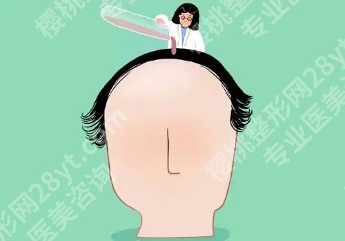 刘玉玲医生植发怎么样?医生技术详情介绍、25年价格一览!