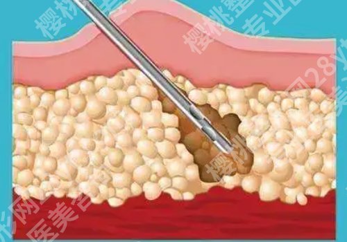 北京王明利博士案例更新!技术超牛、审美在线!
