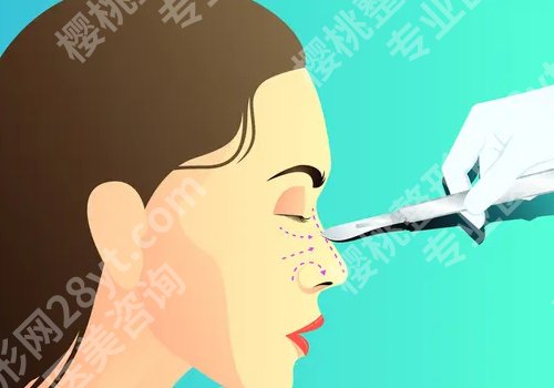 刘立强医生好吗?诉求方案、预约面诊流程、案例效果公布!