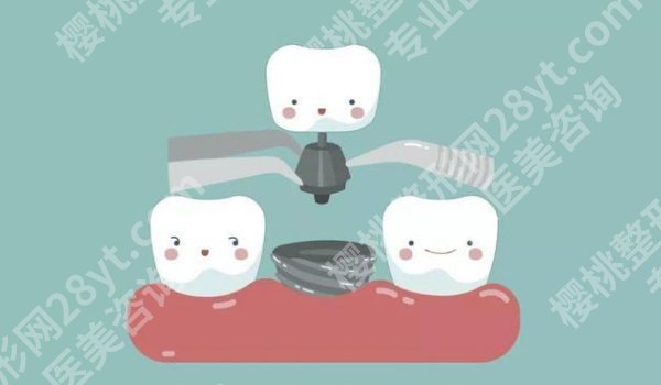 东莞塘厦医院种牙多少钱?价格低至1.6w起!医院亮点一览!