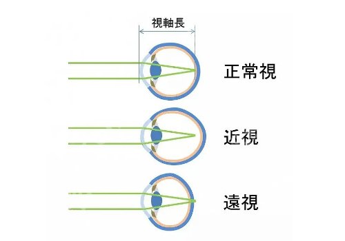 广医一院近视眼手术怎么样?挂号方式、医生选择等更新!