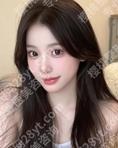 芜湖弋矶山医院美容科割眼袋怎么样?真实案例一览!