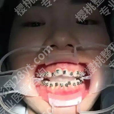 长海医院正畸做的好吗?医院简介、真实案例、交通指南更新!