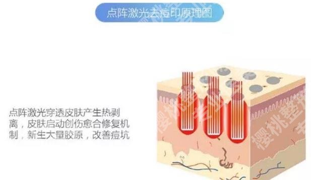 中山三院点阵激光收费表?医院简介