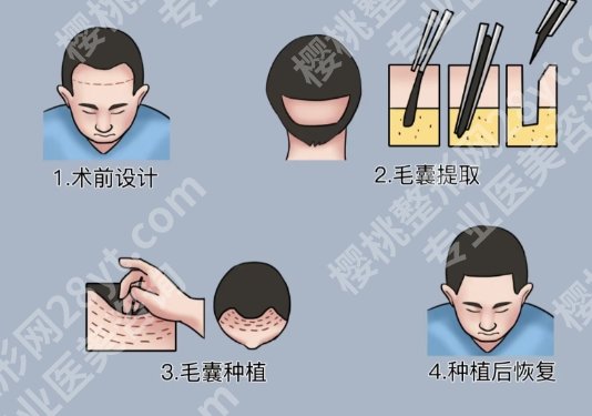 杭州人民医院整形科医生简介?一文查看医院详情