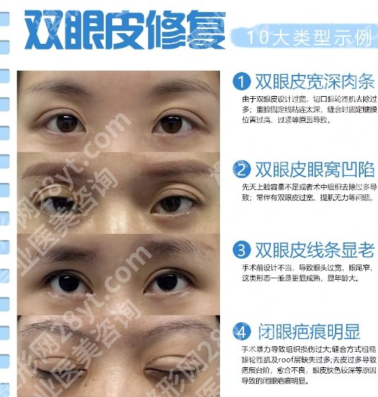 北京301整形修复哪个医生好?周志强、韩岩、陶然案例都挺多的!