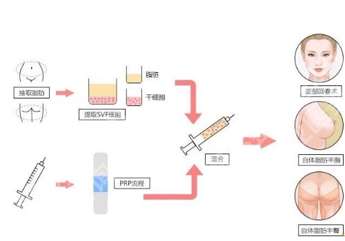 北京八大处脂肪填充怎么样?顾客口碑曝光!好评连连 !