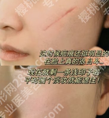杭州祛疤痕医院排行,医院详情介绍