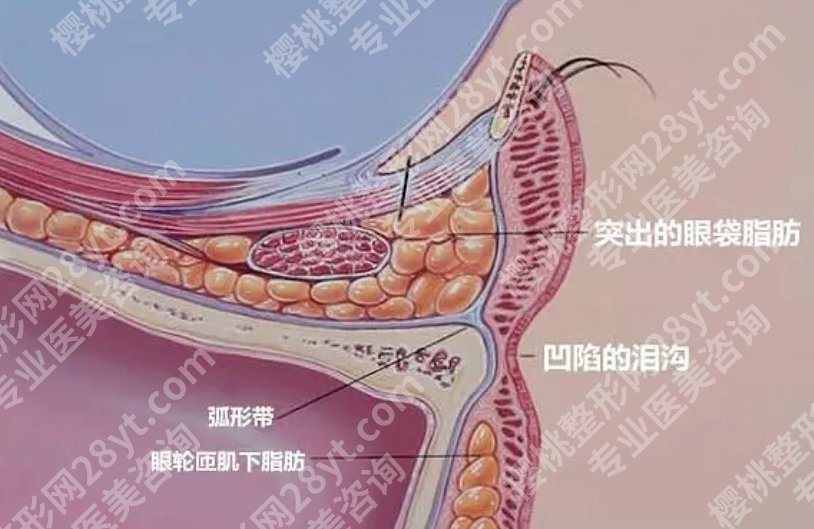 中日友好医院祛眼袋多少钱?医生团队资源丰富!戳进来看