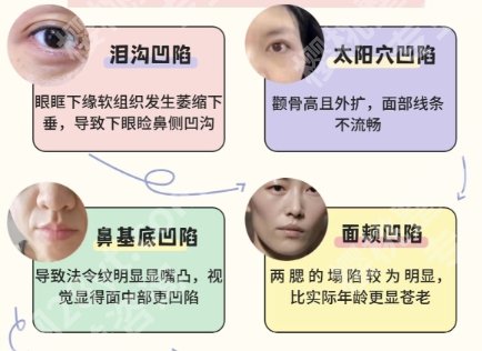 上海九院鼻基底填充价格贵不贵?15199元起,2025收费标准更新!