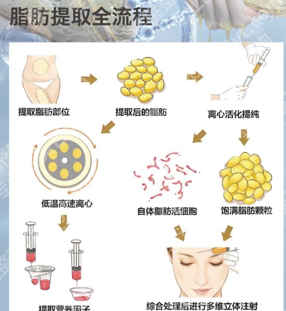 李哲权医生脂肪填充怎么样?一键查看医生信息