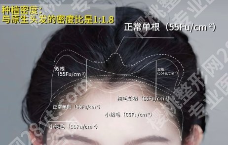 合肥植发正规三甲医院有哪些?看五家医院介绍