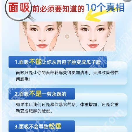 王世虎做面部吸要多少钱?价格贵不贵?价目表参考!