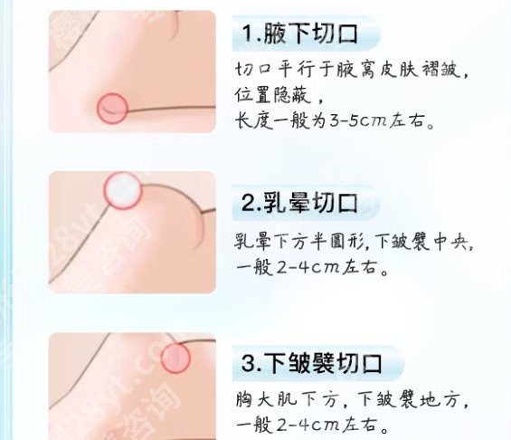 宋建星医生隆胸痛不痛?医生基本信息一站式掌握!