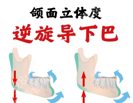 首口颏成型费用贵不贵?全新收费标准更新!戳进来看