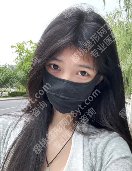 医学科学院整形外科医院植发费用是多少?低至10000元起!附优势信息!