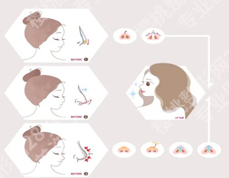 上海管果医生的口碑评价如何?附点评_详细案例优选啦