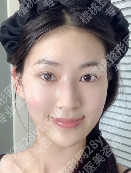 袁玉坤医生做脂肪填充怎么样?医生实力在线!内附新版价格表!
