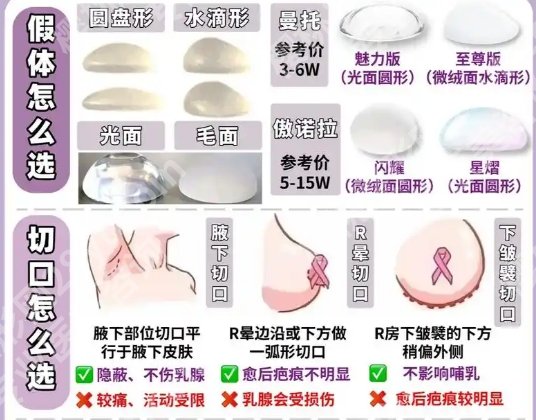 项昌峰医生假体隆胸怎么样?真人案例图反馈!见证蜕变