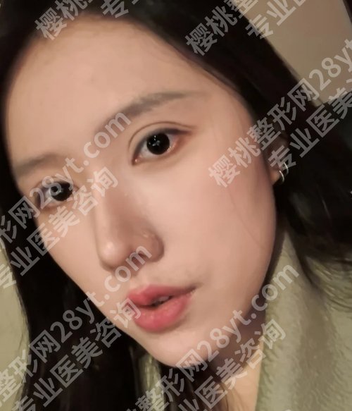 北京空军总医院美容整形中心双眼皮怎么样?附科室资料、项目介绍!