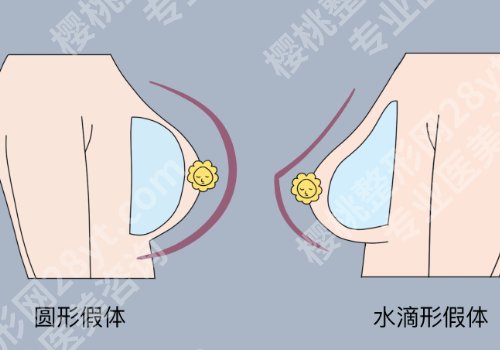 吴毅平医生技术优势更新!技术沉稳、审美在线!