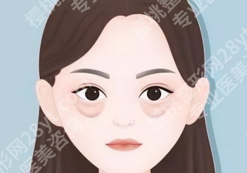 李天石医生做眼袋的口碑评价如何?技术在线、实力强劲!