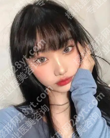 芜湖弋矶山医院激光近视做的怎么样?项目科普、医生详细介绍