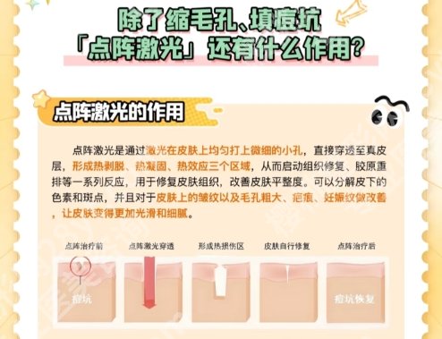 小榄人民医院点阵激光多少钱?分享资料信息!点击收藏