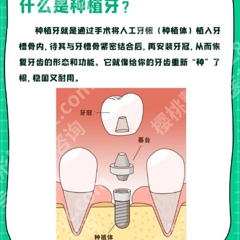 绍兴人民医院种植牙齿哪个医生好?医生擅长项目|经验丰富!