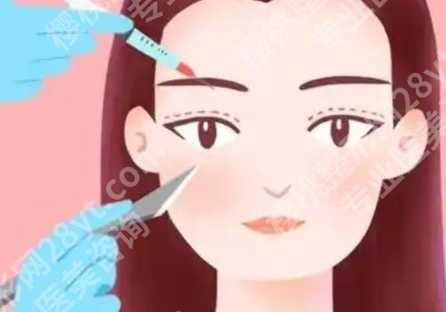 申霄医生做双眼皮修复怎么样?审美独特、技术成稳!
