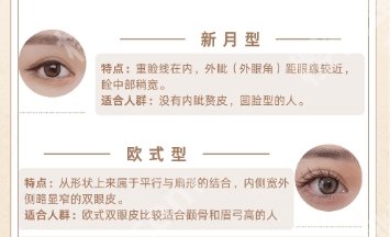 芜湖割双眼皮好的医生有哪些?2025好的医生名单曝光!