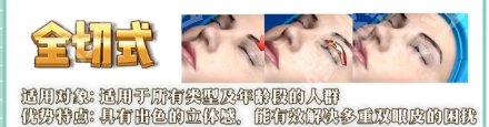 广东揭阳割双眼皮哪家医院好?一键了解医院详情信息!