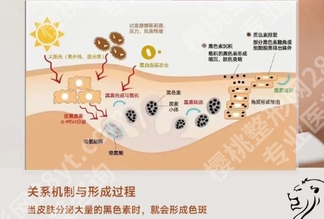 苏州哪家正规医院祛斑*好?医院实力水平出众|项目种类信息!