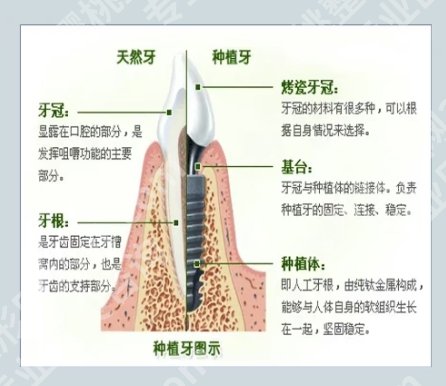 泰州牙齿种植哪家好?医院详细介绍\项目具体信息!