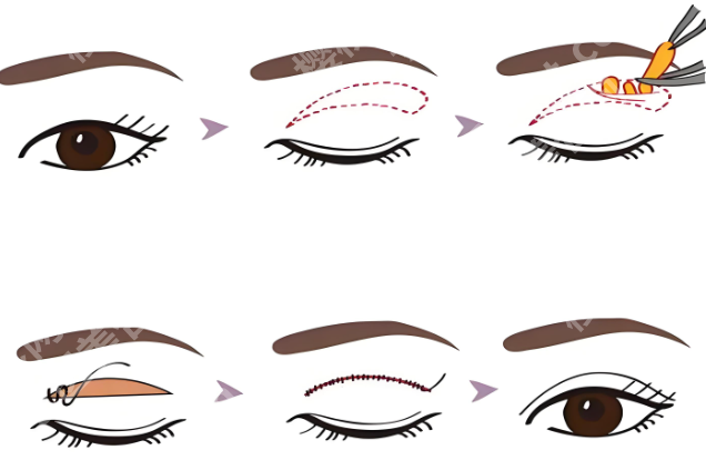 苏州沈国良医师怎么样?这里看看医生技术实力吧