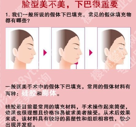 上海九院垫下巴多少钱?医院具体详细介绍!附相关科普知识