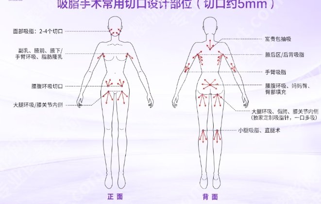 长春吸脂做得好的专家!盘点医生top5名单!点击收藏