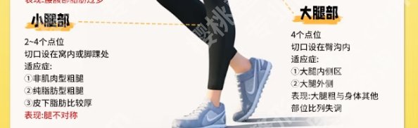 烟台大腿吸脂哪里好?医院反馈|口碑良好!速速码住