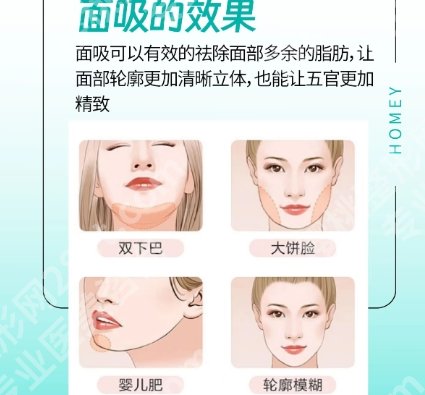 北京做面部吸脂有名的医院!来看看有没有你心仪的医院!
