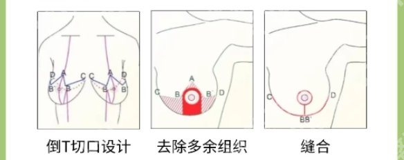 唐志荣医生做隆胸价格更新!医生个人资料简介!价格参考
