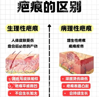 梅州人民医院整形外科口碑如何?专家名单和价目表同步上线
