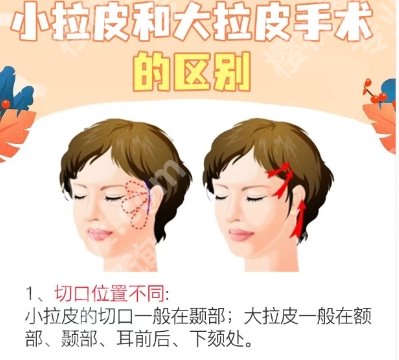 杜太超拉皮属于什么档次?口碑怎么样?医生技术、经验、价格曝光