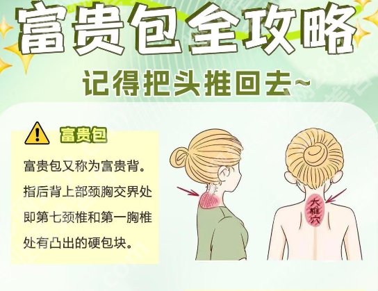 北京协和医院富贵包挂什么科?收费多少钱?科室资料-价格-案例鉴赏!