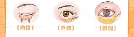 深圳北大医院祛眼袋专家!院内实力医生简介!就诊必看