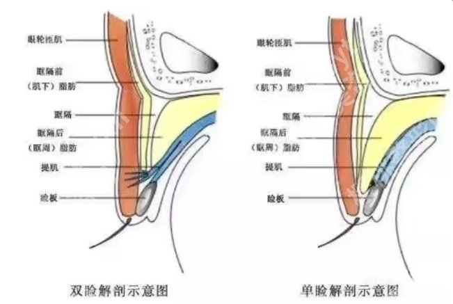 佀同帅医生做双眼皮怎么样?医生详细简介!案例鉴赏